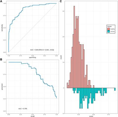 Open access-enabled evaluation of epigenetic age acceleration in colorectal cancer and development of a classifier with diagnostic potential
